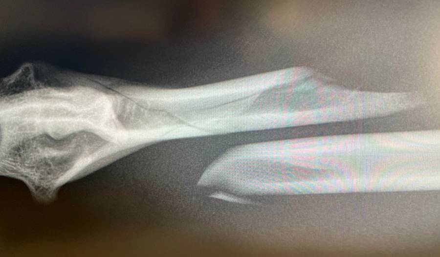 De onmiskenbare botbreuk bij serval Noa.